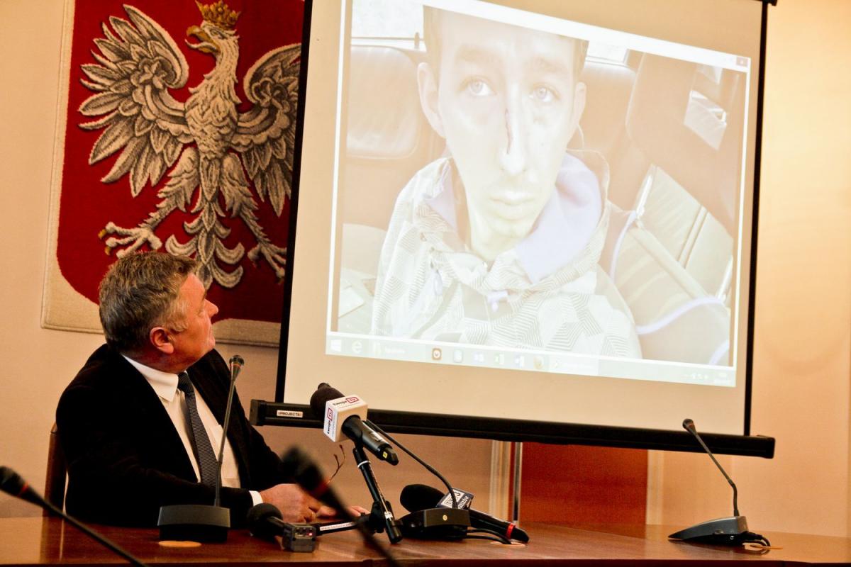 Na konferencji prasowej kilka dni po zajściu wójt Marian Ryznar zapewniał, że nie doszło do pobicia, a sprawa jest prowokacją. Odnosił się też do oskarżeń A. Dworaka.<br/>fot.Roman Kijanka