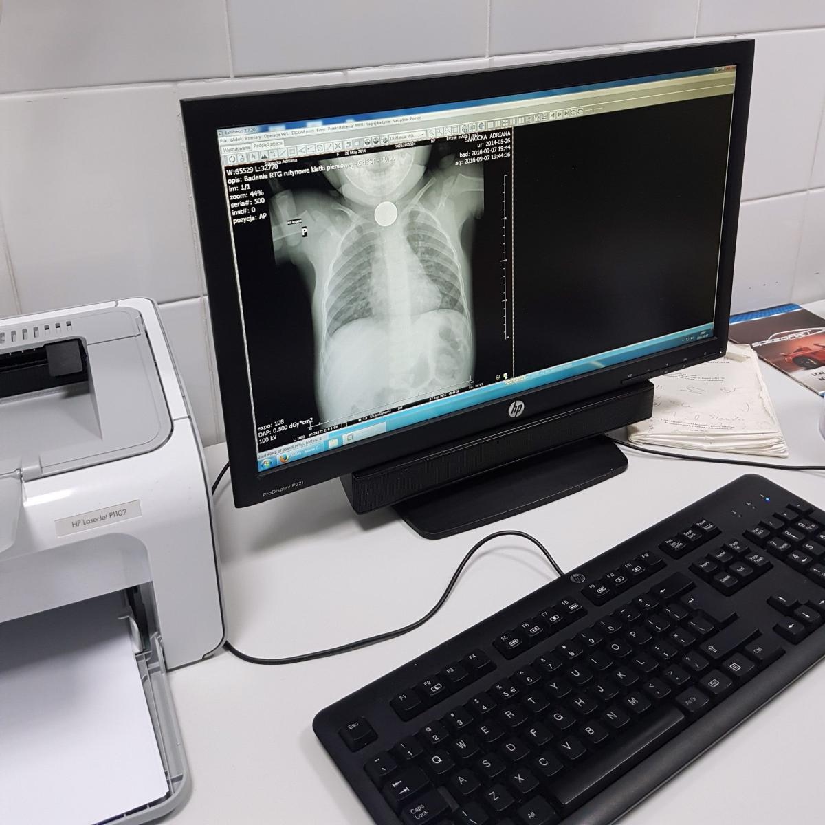 Tak na zdjęciu rtg wyglądała moneta połknięta przez 2-letnią Adę, która utknęła dziecku w przełyku.<br/>fot.ze zbiorów własnych