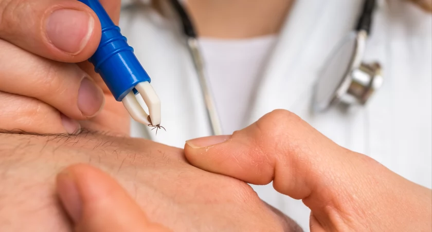  Tylko w ubiegłym roku, w Polsce potwierdzono ponad 25 tysięcy przypadków boreliozy i 659 przypadków kleszczowego zapalenia mózgu. Zakażone kleszcze są bardzo niebezpieczne zarówno dla ludzi, jak i dla zwierząt. 