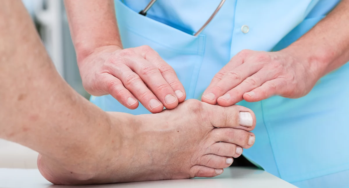 Obecnie jedyną skuteczną metodą leczenia haluksa jest zabieg chirurgiczny. Jeśli po nim pacjent skupi się na poszczególnych krokach rehabilitacji, w trzecim miesiącu po zabiegu jego chód powinien być już płynny, symetryczny i wydolny.
